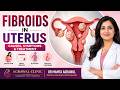 Fibroids in Uterus? Symptoms You Should NOT Ignore!