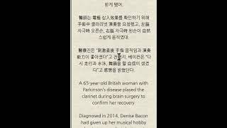 뇌수술 도중 클라리넷 연주하다