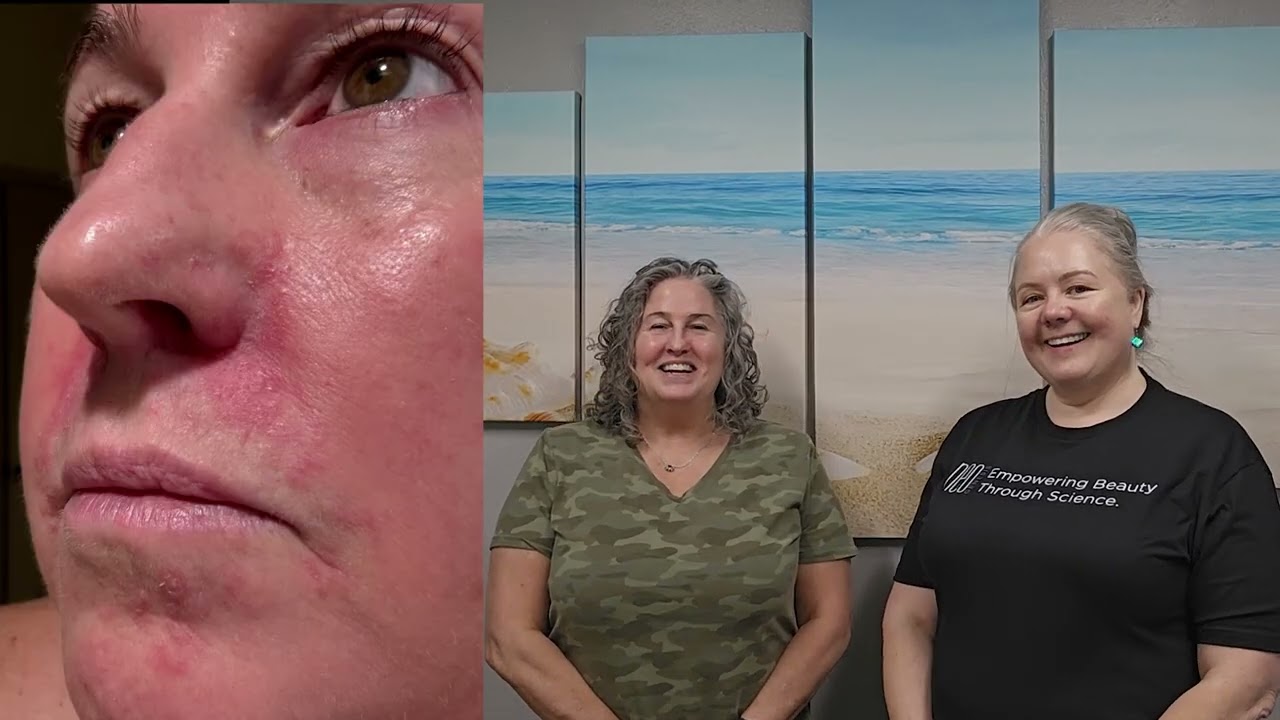 Jamie Renee Asare treating Compromised Skin in TSG2025 - Video 1