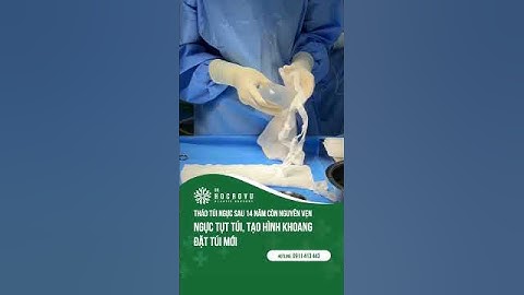 Tháo túi ngực sau 14 năm, túi còn nguyên vẹn #thaotuinguc