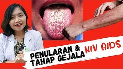 #HIVAIDS 1 | Penularan dan Tahap Gejala HIV AIDS | dr. Ema Surya P - Durasi: 9.57. 