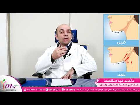 فيديو: كشفت المرأة أسرار التخلص من الذقن المزدوجة بدون جراحة