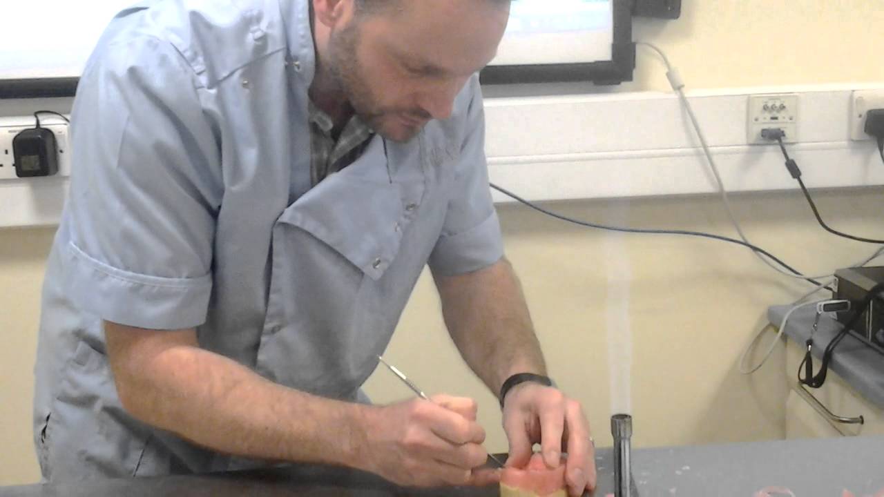 Partial Upper Special Tray YouTube