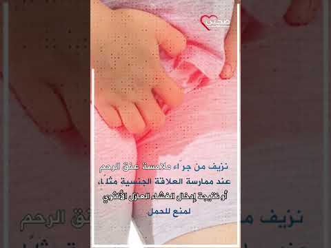 فيديو: ماذا تخبر مسحة عنق الرحم الطبيب؟