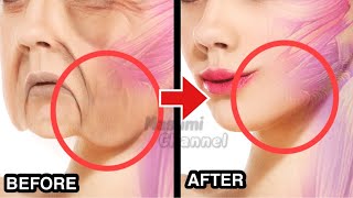 20mins🔥Face Lifting Exercise For Jowls & Laugh Lines(Nasolabial Folds)