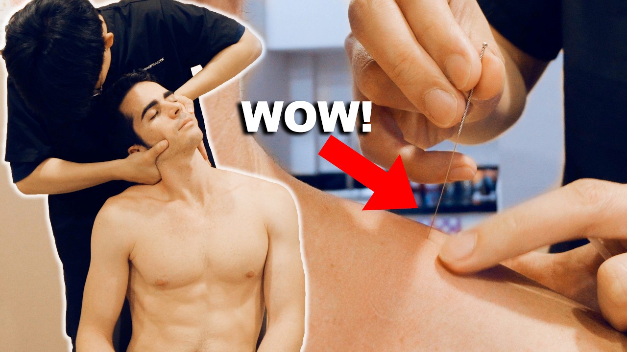 АСМР: Мануальный терапевт лечит мою боль в шее и спине с помощью ТРЕЩИН и Иглоукалывания! Эп. 4