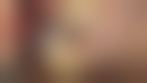 Implantation with Easy Bone Graft Concept