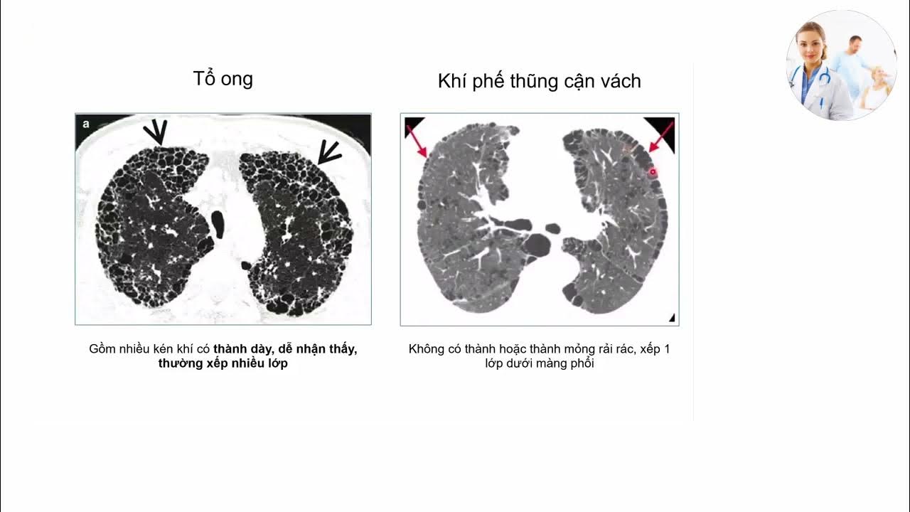 Mơ Thấy Nhiều Tổ Ong - Giải Mã Ý Nghĩa và Những Điều Cần Biết