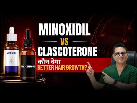 PRP vs Minoxidil for Hair Loss: Which Works Better? - video