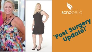 Laser Liposuction Procedure Review | Sono Bello