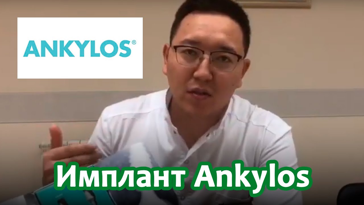 Преимущества Импланта Ankylos для зубов | Doctor Dent