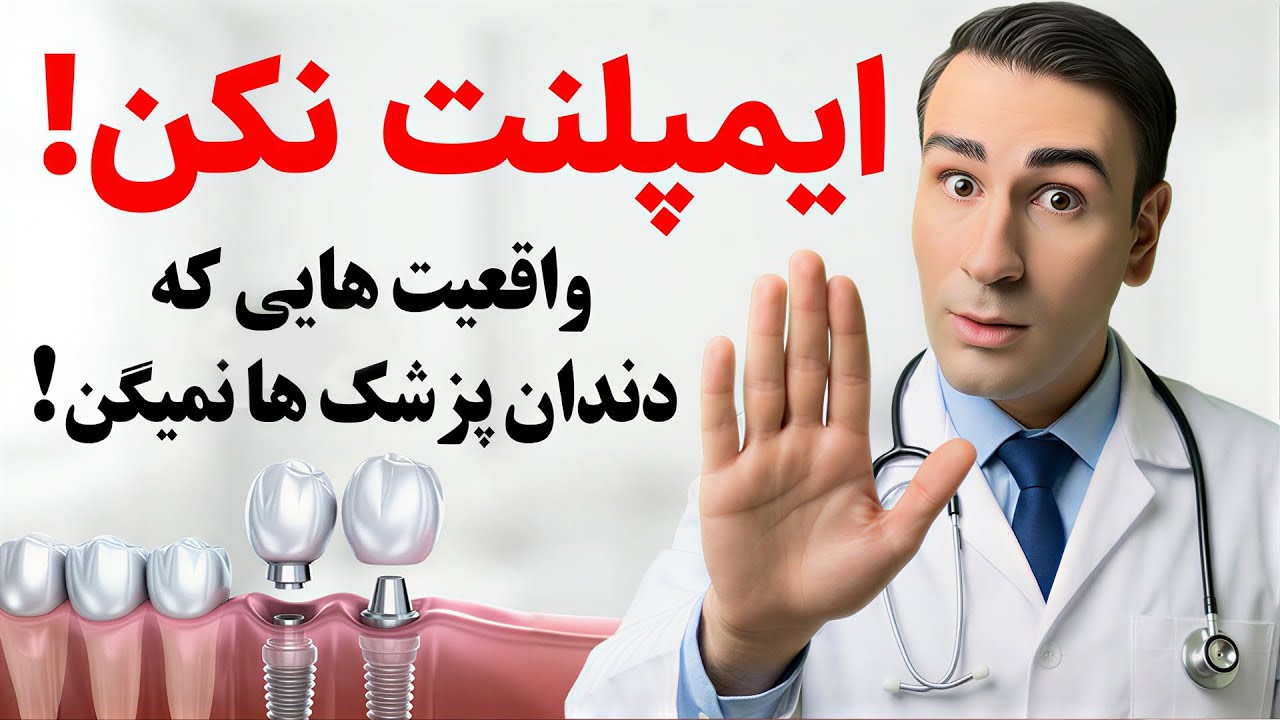 ایمپلنت نکن ! واقعیت هایی که دندان پزشک ها بهت نمیگن!