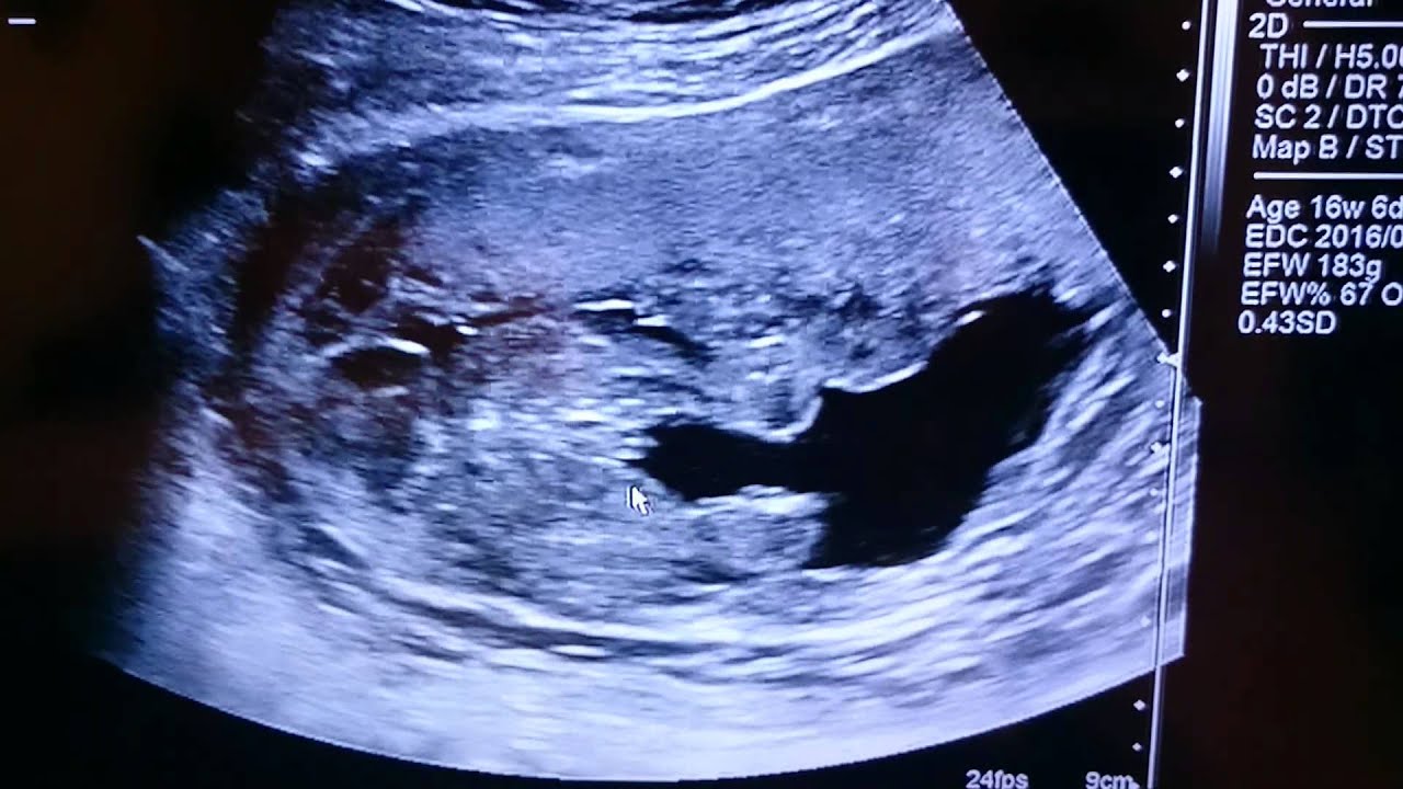 17週エコー Youtube