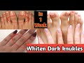 Remove dark knuckles from hand feet in 1 week amazing simple home care