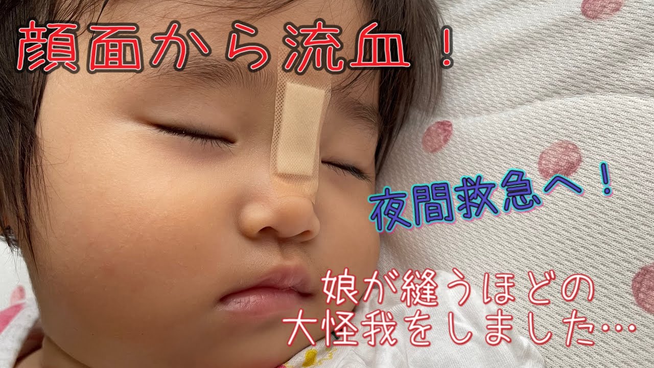 子どもの怪我 顔面から流血 娘が縫うほどの大怪我をしてしまいました Youtube