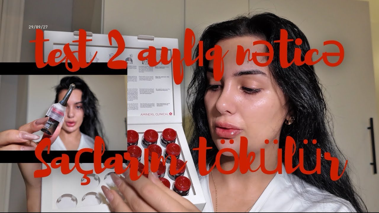 KEÇƏL OLMAĞA QƏRAR VERDİM 😫 XƏSTƏXANADA BAŞIMA HADİSƏ GƏLDİ !😓