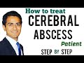 Cerebral/Brain Abscess Treatment, Symptoms, Diagnosis, Infectious Medicine Lecture USMLE