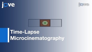 Recording Multicellular Behavior: Myxococcus xanthus Biofilms l Protocol Preview