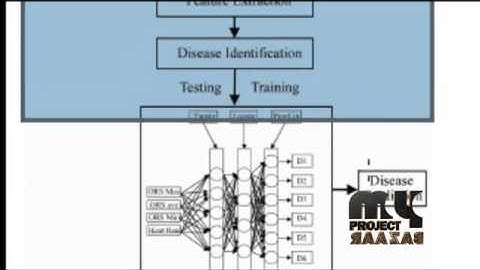Final Year Projects | Cardiac arrhythmias detection in an ECG beat signal using fast