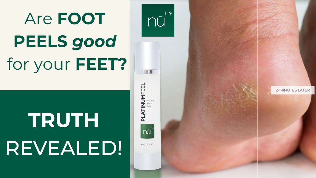 IS A FOOT PEEL GOOD for YOUR FEET? Do They Work on Cracked Heels? 2024reviews beforeafter 