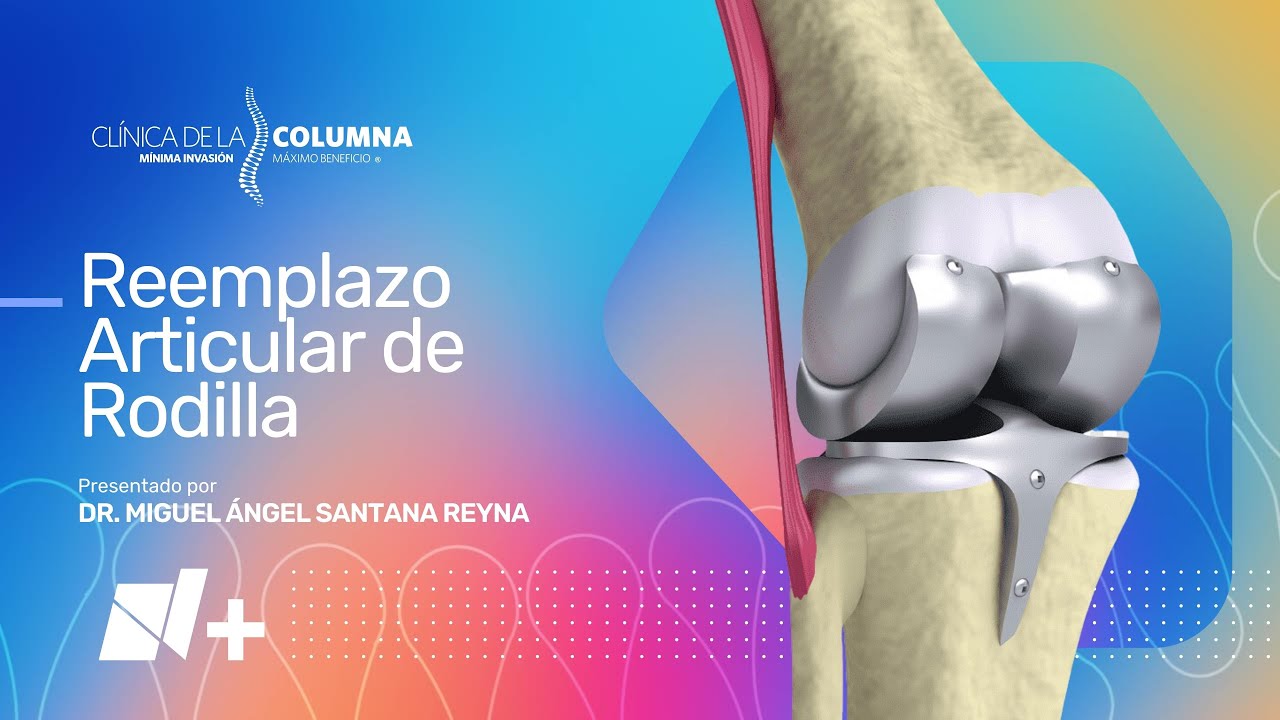 Reemplazo Articular de Rodilla - Clínica de la Columna