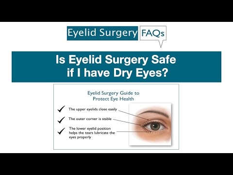ვიდეო: უსაფრთხოა თუ არა თვალის ჩახშობის ოპერაცია?