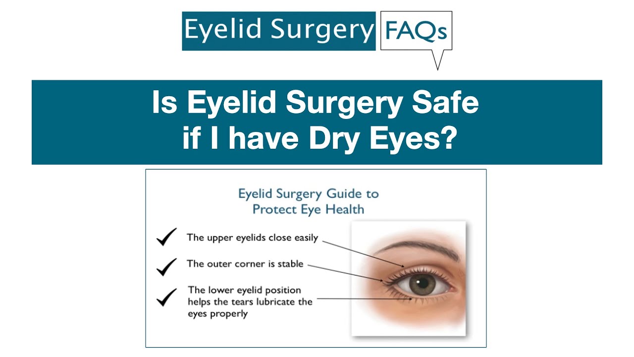 Is Eyelid Surgery Safe if I have Dry Eyes? 