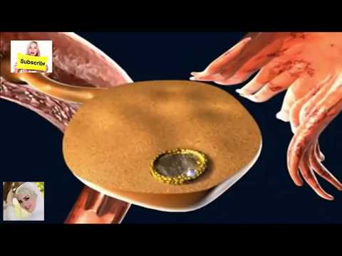 شاهد بالفيديو كيف تحمل المرأة من الرجل