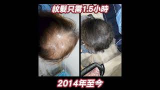 【甩頭髮原因】成因肥都關事？想增髮要紋髮 - 紋髮香港 NPM紋髮專家 改善雄性型脫髮，如「M字額」脫髮、地中海禿髮、營造剷青效果等