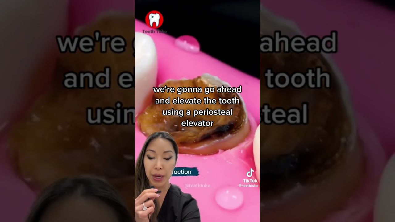 Broken Tooth Extraction Shorts