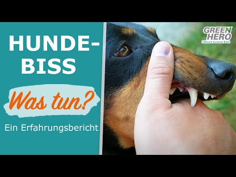 Video: Verhindern von Hundebissen an beiden Enden der Leine