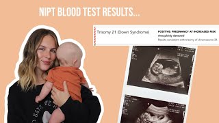 Positive NIPT for trisomy 21/down syndrome | NIPT results story time