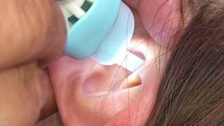【床屋の耳掃除】2020.4.1 電動耳かき　女性モデル　おばあちゃんの耳掃除　イヤークリーナー　耳カス