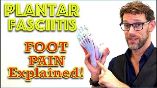 What Causes Plantar Fasciitis - Foot Anatomy - Dr Gill