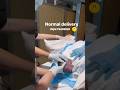 Normal Delivery Viral Video #Baby #Shorts#Newborn