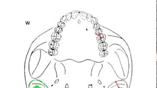 DYNAMIC OCCLUSION - Working vs. Non-working Movement & Occlusal Grid