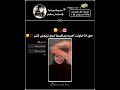 لا تنسوا ايموجي🍣#shorts#مالي_خلق_احط_هاشتاقات #audio #song #speedup #music #explore #blackpinkممم