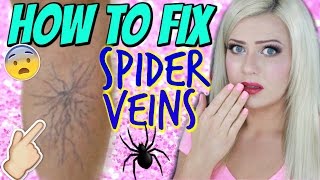 HOW TO HIDE SPIDER VEINS ON YOUR LEGS