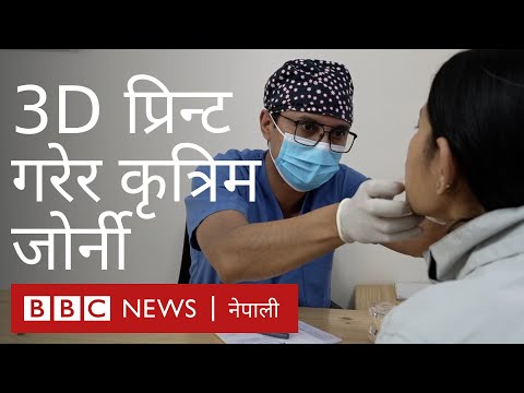 बच्चा बेलामा लडेर चिउँडोमा चोट लागेमा त्यसको असर मुखभित्रको हड्डीमा पर्न सक्छ- बीबीसी न्यूज नेपाली