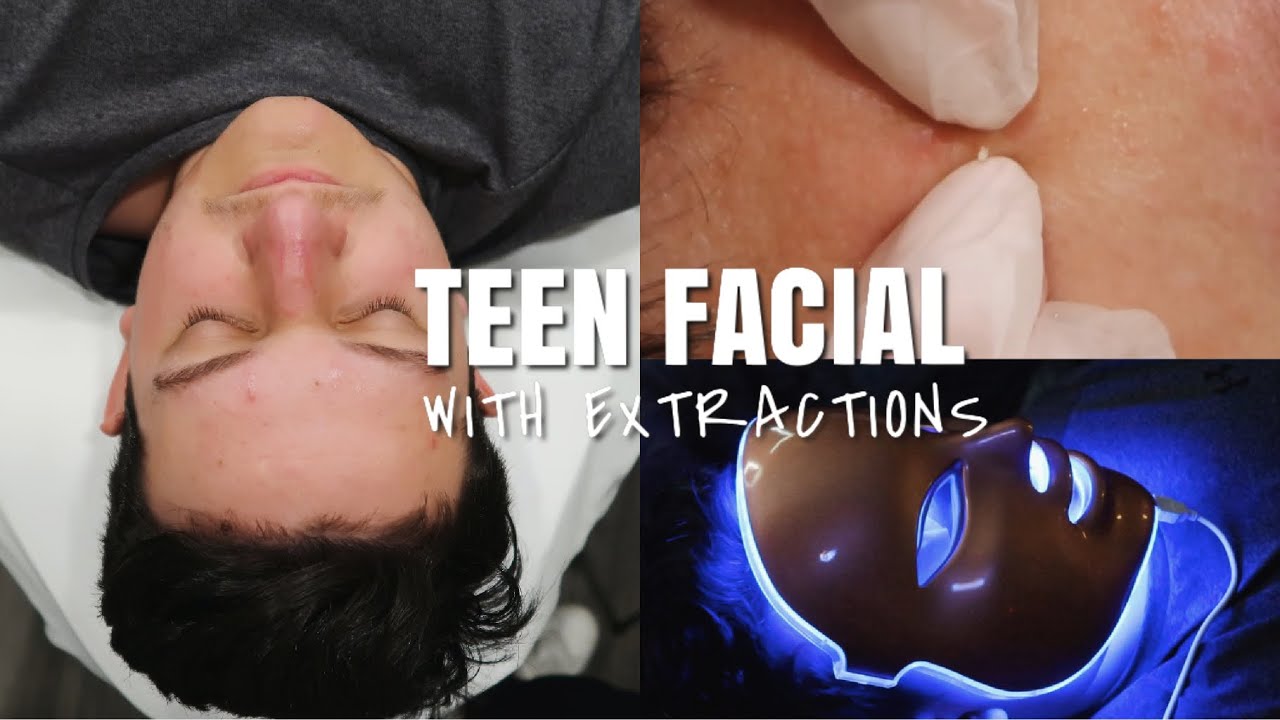 TEEN ACNE FACIAL (Close Up Extractions & LED Light Therapy)