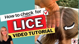 How to Check for Lice Video Tutorial