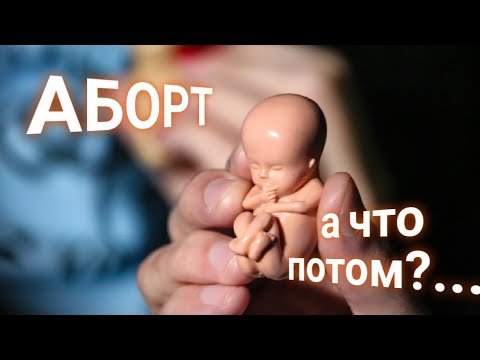 ЭНЕРГОИНФОРМАЦИОННЫЙ ГИПНОЗ. Аборт.