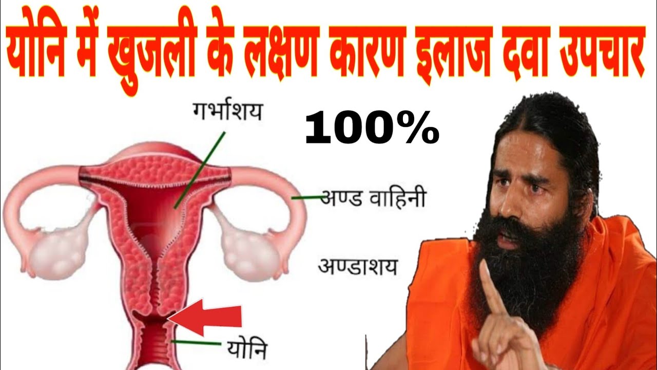 योनि में खुजली के लक्षण, कारण ,इलाज ,दवा, उपचार और परहेज,Vaginal itching symptoms, - YouTube