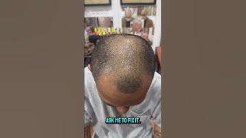 Tóc thưa mỏng khiến bạn trở nên già hơn, vậy làm sao để cải thiện vấn đề, hãy xem hết video