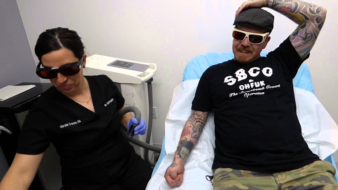 tattoo artist gets tattoo removal u0026 shows off black leg youtube tattoo artist gets tattoo removal u0026 shows off black leg youtube