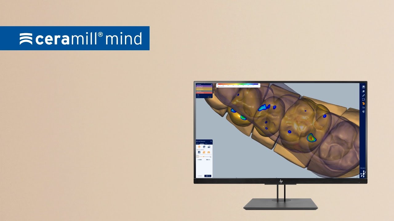 Ceramill Mind CAD Software for dental restorations - YouTube