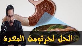 وصفات خاصة لعلاج مشاكل المعدة و أمراض أخرى  - الدكتور جمال الصقلي -