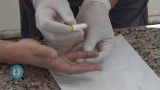 PROF  JUAN VIÑABAL PUNCIÓN CAPILAR