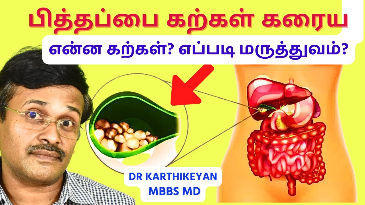 பித்தப்பை கற்கள் கரைய என்ன செய்யலாம்? | gallbladder stone symptoms