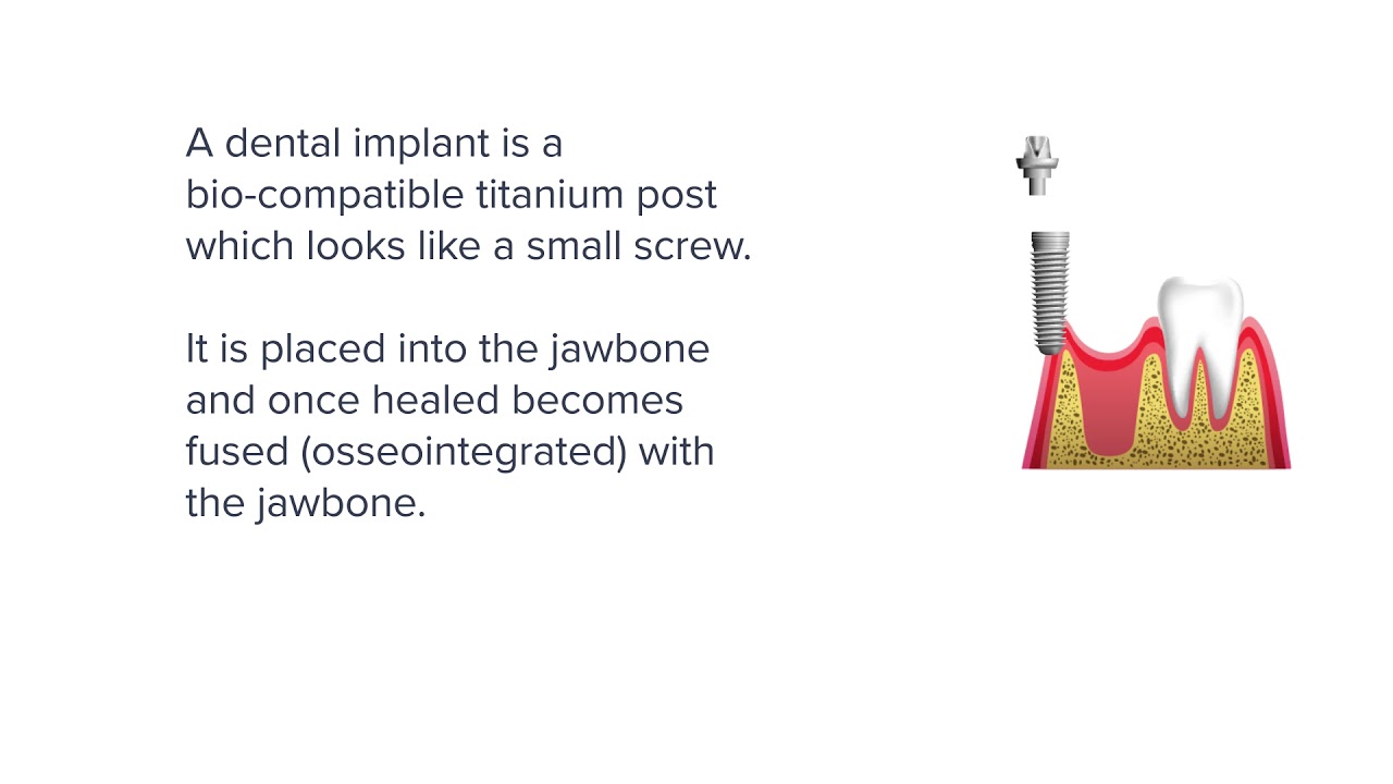 youtube-video-thumbnail